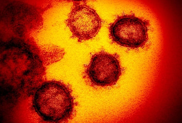 electron microscope image, U.S. National Institutes of Health, Novel Coronavirus SARS-CoV-2,